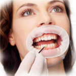 ABREBOCA OPTRAGATE REGULAR